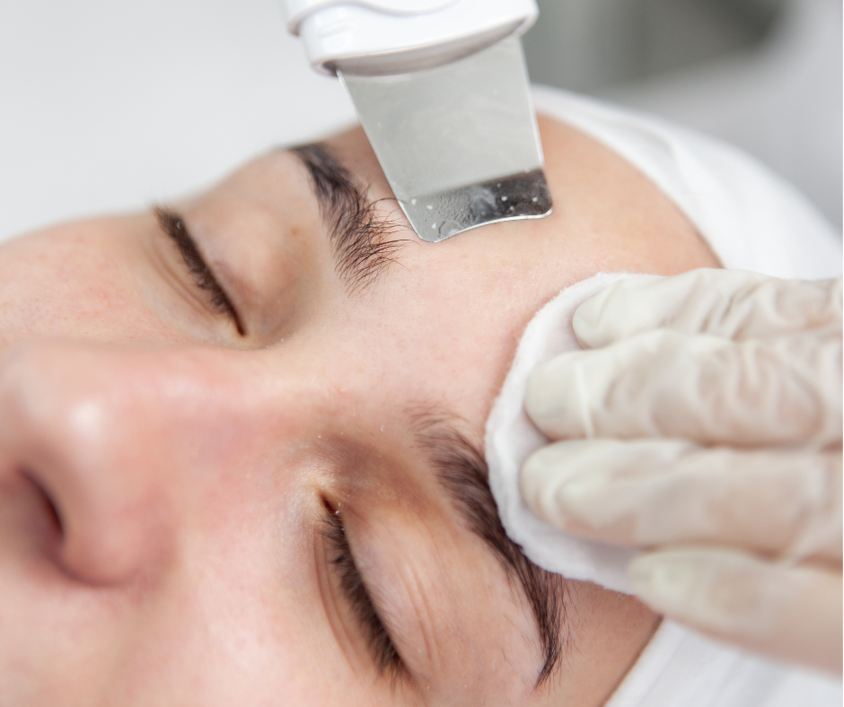 Peeling kawitacyjny – Voucher